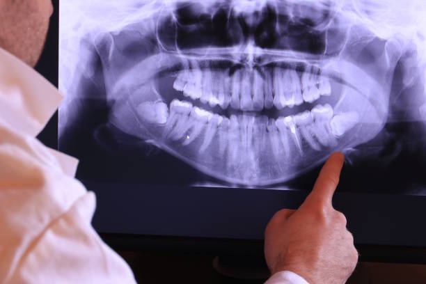 Best Emergency Dental Filling Replacement  in Pascagoula, MS
