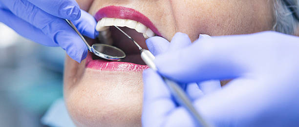 Best Dentist for Tooth Abscess  in Pascagoula, MS